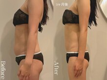 ユーフォリア グロウ(euphoria glow)/｛　ラフォス痩身90分 4回　}