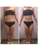 ナレル(narrel)/(新潟市/骨盤/痩身/ダイエット)