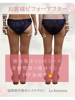 ラ フェミニン(La feminine)/20代モニター様☆下半身15回