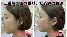 ノゾミジュク(希美熟 NOZOMIJUKU)