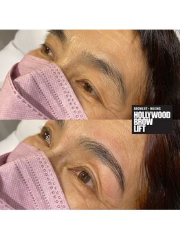 アンアイサロン(UNE)/年齢性別関係なくできるHBL