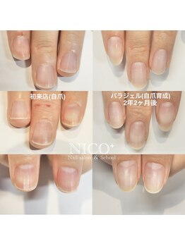 ニコプラス(NICO+)/自爪育成中