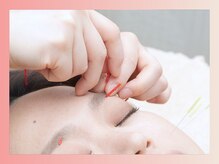 ラピス 玉造(Lapis)の雰囲気（東洋医学のプロによる中からキレイになれる美容鍼灸♪[小顔]）