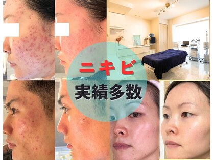 素肌キレイラボ(素肌キレイLab.)の写真