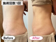 ハロ(Halo)/腸もみマッサージ・腸セラピー