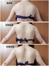 イスタナ ロゼ/ブライダルエステ