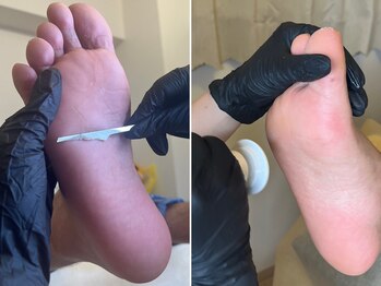 ベベ(Bebe)/ 韓国式足裏角質ケア[70分]¥7900