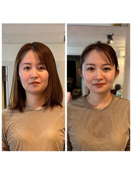 サワコウボウ セラピー(SAWAKOBO therapy)/小顔整体セラピー別人級の変化