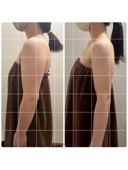 ベリンダ 中崎町店(BELINDA)/巻き肩解消！