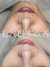 バーム(BAUM.)/最強毛穴ケア！