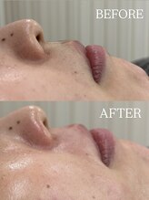 ラキ(LAKI)/フェイシャルワックス