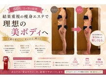 ラナン(Ranan)