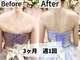 プラディンケリエの写真