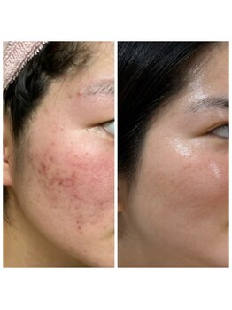 シュシュビエン(Chou Chou Bien)/肌を根本的に改善♪