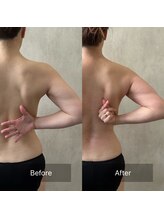 凰湖/ブライダルケア（1回での変化）