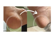 ピエモワ 渋谷(PiEmoi)/足裏ツルツル♪