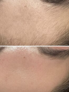 リアンジェ(Lianje)の写真/人気のブラジリアンワックス脱毛サロン★肌質/毛質/部位別に合わせた施術で驚きの脱毛＆美肌効果◎