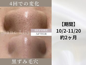 ブランリリー(Blanc Lily)