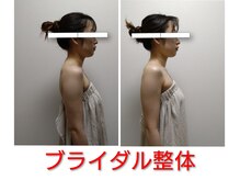 キュアボディ(Cure Body)/ブライダル/骨盤矯正/小顔/腰痛