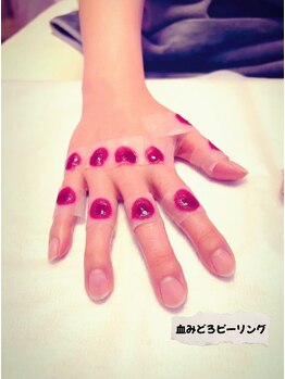 サロンドチル(SALONdeCHILL)/話題の血みどろピーリングでケア