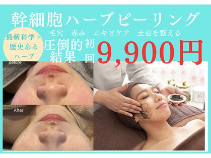 サロンツキ(salon tuki)の写真