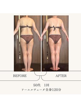 アーユルヴェーダアンドアロマエステ アユス(AYUS)/【50代】巻き肩もスッキリ