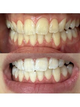 ライトビューティー 池袋店(LightBeauty)/症例写真