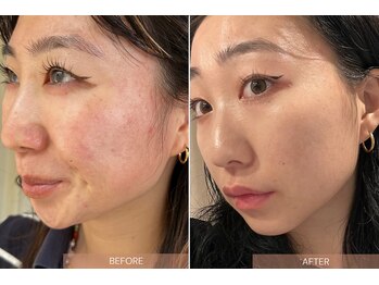 ラフバイディアブルー(Laugh by diarblue)/クリスティーナ ピーリング