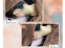 ディオーネ 上越南高田店(Dione)/うなじ脱毛