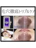 【毛穴悩み人気No. 1】毛穴洗浄＋ヴィクトリア最強タックで黒ずみ・開きに★