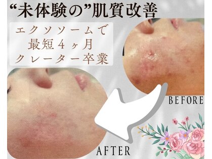 ドゥマイン(Do Mynd)の写真