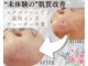 ドゥマイン(Do Mynd)の写真