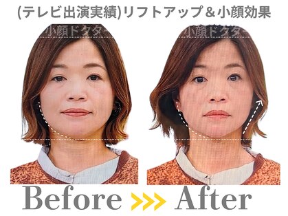 小顔ドクターの写真