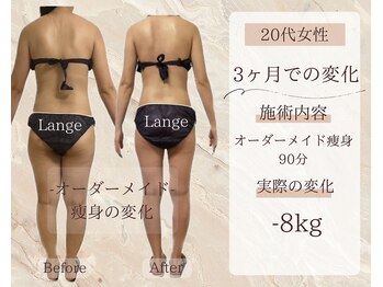 サロン ド ボーテ ラーンジュ 岐阜店(salon de beaut'e L'ange)/ハイパ-ナイフEX2ダイエット痩身