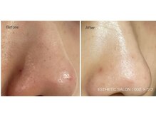 1002(トウフ)/BEFORE/AFTER 