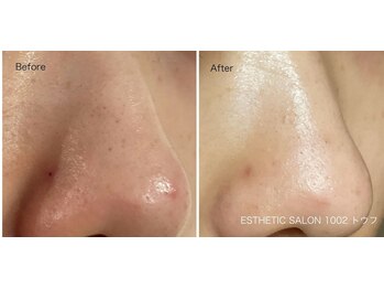 1002(トウフ)/BEFORE/AFTER 