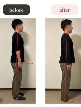 K.C鍼灸院サロン/ビフォーアフター写真