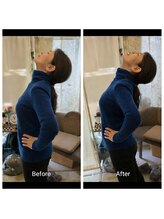 ここち整体院/反らすと痛い腰の変化