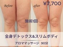 フルーブラン(Frubran)/本気の全身スリムケア