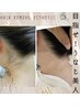 これであなたも【うなじ美人♪】初回¥3500→¥2000