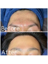 トータルメンズエステ キング(KING)/男性用肌改善コスメ取り扱い