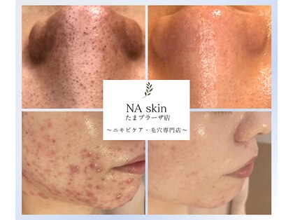 エヌエースキン たまプラーザ店(NAskin)の写真