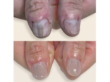 ハッカネイル(HAKKA NAIL)