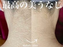 カナウ produced by きょうわ整体院(Kanau.)の雰囲気（意外に目立つうなじ！脱毛でツルスベ肌目指しましょう☆）
