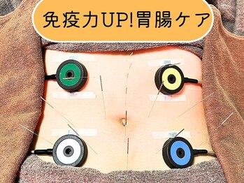 仁接骨院 じん鍼灸治療院/胃腸ケア鍼灸