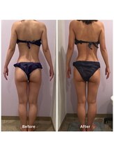 ナレル(narrel)/(新潟市/骨盤/痩身/ダイエット)