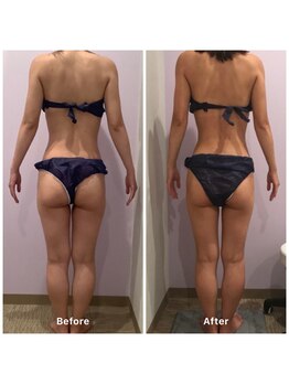 ナレル(narrel)/(新潟市/骨盤/痩身/ダイエット)