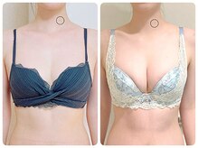 美人バスト リグラス(ReGrous)の雰囲気（【C→Gカップ実績あり】施術×栄養で持続可能なバストアップ法☆）