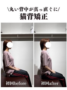 神田はぴねす鍼灸整骨院/【神田】施術変化初回