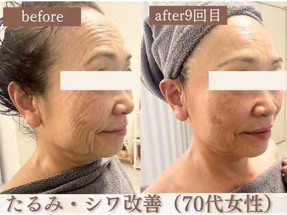 スリーエッセンス(3THREE ESSENCE)の写真